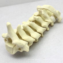 TF01 (12312) C1-C7 Cervical Vertebra Bones,SWABone Models / Spine-Cervical / Cervical Vertebrae